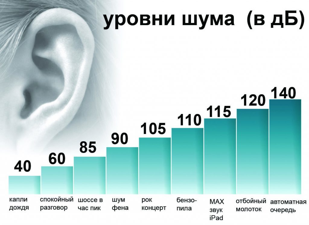 интензитет на шума