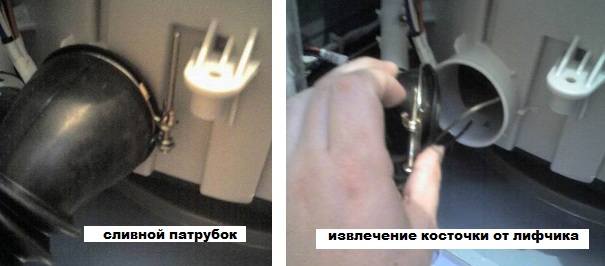 премахване на жицата от сутиена през дренажната тръба